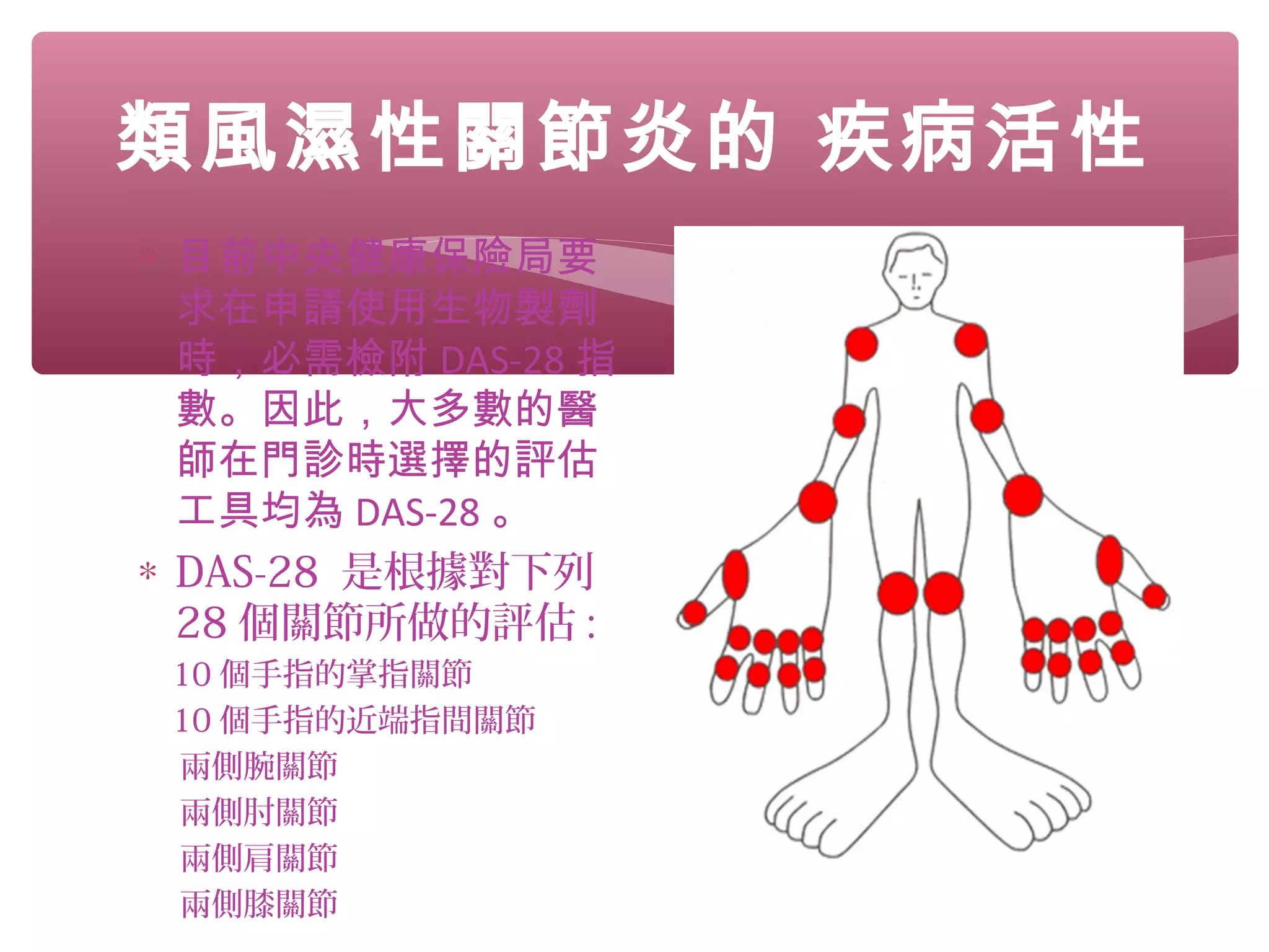 ∗ 目前中央健康保險局要
求在申請使用生物製劑
時，必需檢附 DAS-28 指
數。因此，大多數的醫
師在門診時選擇的評估
工具均為 DAS-28 。
∗ DAS-28 是根據對下列
28 個關節所做的評估 :
10 個手指的掌指關節
10 個手指的近端指間關節
兩側腕關節
兩側肘關節
兩側肩關節
兩側膝關節
類風濕性關節炎的 疾病活性
 