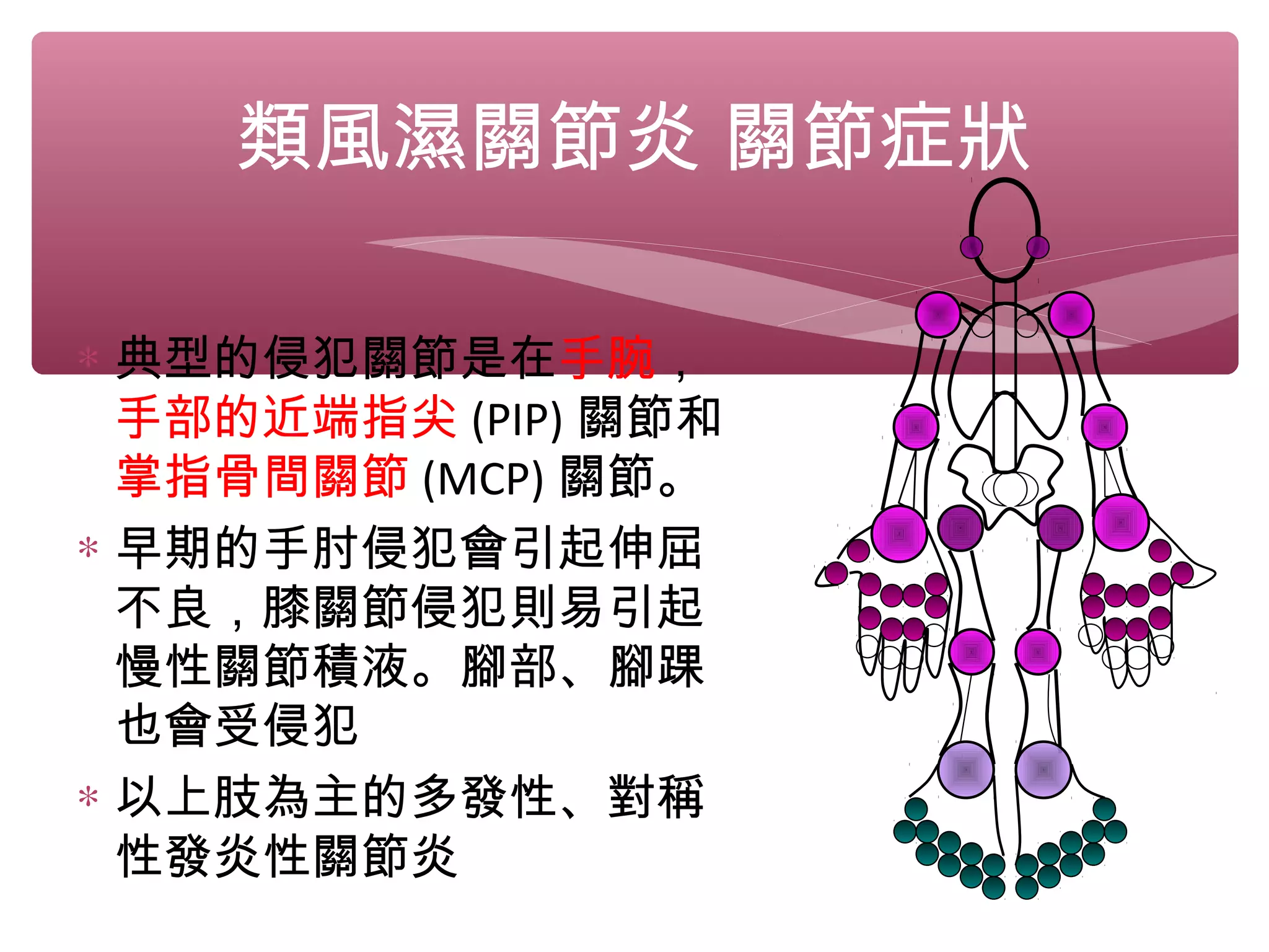 類風濕關節炎 關節症狀
∗ 典型的侵犯關節是在手腕，
手部的近端指尖 (PIP) 關節和
掌指骨間關節 (MCP) 關節。
∗ 早期的手肘侵犯會引起伸屈
不良，膝關節侵犯則易引起
慢性關節積液。腳部、腳踝
也會受侵犯
∗ 以上肢為主的多發性、對稱
性發炎性關節炎
 