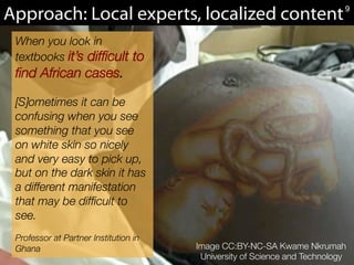 Image CC:BY-NC-SA Kwame Nkrumah 
University of Science and Technology
Approach: Local experts, localized content
When you look in
textbooks it’s difﬁcult to
ﬁnd African cases. 

[S]ometimes it can be
confusing when you see
something that you see
on white skin so nicely
and very easy to pick up,
but on the dark skin it has
a different manifestation
that may be difﬁcult to
see.

Professor at Partner Institution in
Ghana
9
 