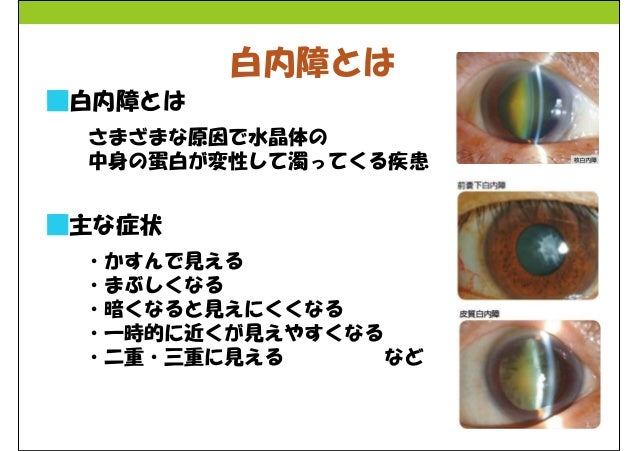 白内障と緑内障 病棟勉強会