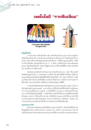 112
ผลงานวิจัย สวทช. สูเชิงพาณิชย ป 2549 - 2556
เทคโนโลยี “รากฟนเทียม”
ข้อมูลเบื้องต้น :
	 การรักษาด้วยรากฟันเทียมคือการฝังรากฟันเทียมลงในกระดูกขากรรไกรของผู้ป่วย
เพื่อใช้เป็นหลักสำหรับการทำฟันปลอมชนิดติดแน่นเพื่อทดแทนรากฟันที่หลุดหรือถอน
ออกไป หลังจากที่ทำรากฟันเทียมลงไปแล้วจะต้องทิ้งเวลา เพื่อให้กระดูกเจริญเติบโต เข้ายึด
เกาะที่รากฟันเทียม ซึ่งจะต้องใช้ระยะเวลา 3 - 6 เดือน จากนั้นจึงจะทำการครอบฟันปลอม
ลงบนรากฟันเทียมอีกชั้นหนึ่ง หลังจากนั้นผู้ป่วยจะสามารถใช้งานฟันซี่ที่ทำการฝังรากฟันเทียม
ในการบดเคี้ยวอาหารได้ตามปกติ
	 ปัจจุบันประเทศไทยมีการทำทันตกรรมรากฟันเทียมประมาณ 7,000 ชิ้นงานต่อปี
หรือคิดเป็นมูลค่านำเข้ากว่า 105,000,000 บาทต่อปี เป็นเทคโนโลยีที่นำเข้าทั้งหมด ซึ่งมีราคา
แพงและต้นทุนส่วนใหญ่เป็นค่าลิขสิทธิ์โดยที่มีค่าวัสดุจริงไม่ถึง 10% ของราคาที่นำเข้า รวมทั้ง
แนวโน้มการใช้งานในประเทศที่เพิ่มขึ้น ตลาดมีการเติบโตเร็วมาก ดังนั้นหากสามารถลดราคา
ให้ต่ำลงได้ ประชาชนก็จะมีโอกาสได้ใช้งานมากขึ้นและมีสุขภาพที่ดีขึ้น
	 รากฟันเทียมที่ทีมวิจัยพัฒนาใช้วัสดุโลหะประเภทไทเทเนียมในการผลิต เนื่องจาก
เป็นวัสดุที่เซลล์กระดูกของมนุษย์ สามารถยึดเกาะในพื้นผิววัสดุได้ดีโดยไม่มีการปฏิเสธของ
ร่างกายและเป็นที่นิยมทางการแพทย์ การวิจัยนี้ได้ทำการออกแบบรากฟันเทียมให้กระดูก
สามารถเข้าไปยึดฝังตัวในวัสดุได้ดี รวมทั้งทำให้ความเค้นที่เกิดขึ้นบนกระดูกที่ติดกับตัวฝังยึด
มีค่าลดลง นอกจากการใช้งานที่กล่าวมาแล้ว ตัวฝังยึดในกระดูกแบบเกลียวนี้สามารถนำไปใช้
งานเป็นหมุดหรือเสาหลักในชุดหูเทียม เอ็นระหว่างข้อต่อเข่า หรือข้อศอก เป็นต้น เป็น
การทดแทนอวัยวะส่วนที่ขาดหายไปให้สามารถกลับมาทำหน้าที่ได้เหมือนเดิม
จุดเด่นของงานวิจัย :
	 ทันตกรรมรากฟันเทียมแบบตัวฝังยึดในกระดูกแบบเกลียวใน เป็นเทคโนโลยีทันตกรรม
ขั้นสูงที่พัฒนาโดยการวิจัยร่วมระหว่าง ADTEC และ MTEC สามารถทดแทนการนำเข้า
เทคโนโลยีและอุปกรณ์ทางทันตกรรมจากต่างประเทศซึ่งมีราคาแพงเป็นการตอบสนองนโยบาย
 