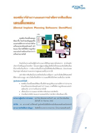 57
ซอฟต์แวร์ช่วยวางแผนการผ่าตัดรากฟันเทียม
เดนตี้แพลน
(Dental Implant Planning Software: DentiPlan)
	 ปัจจุบันในประเทศไทยมีผู้ป่วยจำนวนมากที่มีปัญหาสุขภาพในช่องปาก ส่วนใหญ่มัก
เกิดจากโรคฟันผุและโรคเหงือก โดยเฉพาะผู้สูงอายุที่สูญเสียฟันไปทั้งหมดและต้องใส่ฟันเทียม
ทั้งปากหรือเกือบทั้งปาก การฝังรากเทียมนี้จะช่วยเป็นที่ยึดฟันเทียมให้ติดแน่น อันจะช่วยลด
ปัญหาสุขภาพในช่องปากและสามารถพูดและบดเคี้ยวอาหารได้
	 แต่การฝังรากฟันเทียมในประเทศไทยยังเป็นงานที่ยุ่งยาก และจำเป็นต้องใช้ทันตแพทย์
ที่มีความชำนาญสูง เพราะไม่มีเครื่องมือในการวางแผนที่ดีก่อให้เกิดความเสี่ยงในการผ่าตัด
จุดเด่นของเทคโนโลยี :
	 •	 ซอฟต์แวร์เดนตี้แพลนที่พัฒนาขึ้นเพื่อจำลองรูปฟันแบบสามมิติจากการถ่ายภาพ
ด้วยเครื่องเอกซเรย์คอมพิวเตอร์ (CT Scan) ภาพที่ได้มีความถูกต้องและแม่นยำ
เสมือนจริง มากกว่าเครื่องถ่ายภาพรังสี
	 •	 เพื่อช่วยในการวางแผนการผ่าตัดรากฟันก่อนการผ่าตัดจริง
	 •	 ช่วยเพิ่มประสิทธิภาพและความปลอดภัยในการผ่าตัดรากฟันเทียมมากขึ้น
หน่วยงานผู้ขอรับการถ่ายทอด : มหาวิทยาลัยสงขลานครินทร์ และ มหาวิทยาลัยมหิดล
เมื่อวันที่ 24 กันยายน 2552
นักวิจัย : ดร. เสาวภาคย์ ธงวิจิตรมณี ศูนย์เทคโนโลยีอิเล็กทรอนิกส์และคอมพิวเตอร์แห่งชาติ
สถานภาพทรัพย์สินทางปัญญา : ลิขสิทธิ์ประเภทงานวรรณกรรม (โปรแกรมคอมพิวเตอร์)
	 ซอฟต์แวร์เดนตี้แพลนถูก
พัฒนาขึ้น โดยจำลองข้อมูลรูปฟัน
แบบสามมิติจากการถ่ายภาพด้วย
เครื่องเอกซเรย์คอมพิวเตอร์ (CT
Scan) ซึ่งภาพที่ได้มีความถูกต้อง
และแม่นยำเสมือนจริงมากกว่า
เครื่องถ่ายภาพรังสี
 