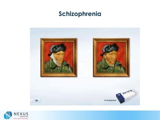 Schizophrenia
 