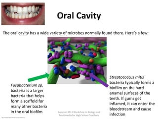 Oral Cavity
The oral cavity has a wide variety of microbes normally found there. Here’s a few:

Fusobacterium sp.
bacteria is a larger
bacteria that helps
form a scaffold for
many other bacteria
in the oral biofilm
http://en.wikipedia.org/wiki/File:Teeth_by_David_Shankbone.jpg

Summer 2012 Workshop in Biology and
Multimedia for High School Teachers

Streptococcus mitis
bacteria typically forms a
biofilm on the hard
enamel surfaces of the
teeth. If gums get
inflamed, it can enter the
bloodstream and cause
infection

 