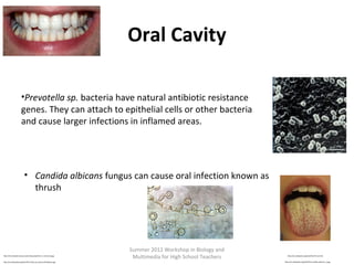 Oral Cavity
•Prevotella sp. bacteria have natural antibiotic resistance
genes. They can attach to epithelial cells or other bacteria
and cause larger infections in inflamed areas.

• Candida albicans fungus can cause oral infection known as
thrush

http://microbewiki.kenyon.edu/index.php/File:P_ruminicola.jpg
http://en.wikipedia.org/wiki/File:Teeth_by_David_Shankbone.jpg

Summer 2012 Workshop in Biology and
Multimedia for High School Teachers

http://en.wikipedia.org/wiki/File:Thrush.JPG
http://en.wikipedia.org/wiki/File:Candida_albicans_2.jpg

 