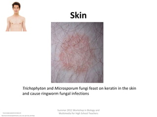 Skin

Trichophyton and Microsporum fungi feast on keratin in the skin
and cause ringworm fungal infections

http://en.wikipedia.org/wiki/File:Yeartinfection.JPG
http://commons.wikimedia.org/wiki/File:Anterior_view_of_male_upper_body,_retouched.jpg

Summer 2012 Workshop in Biology and
Multimedia for High School Teachers

 