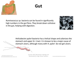 Gut
Ruminococcus sp. bacteria can be found in significantly
high numbers in the gut flora. They break down cellulose
in the gut, helping with digestion.

Helicobacter pylori bacteria has a helical shape and colonizes the
stomach and upper G.I. tract. It is known to be a major cause of
stomach ulcers, although many with H. pylori do not get ulcers.

http://microbewiki.kenyon.edu/index.php/File:G_reaction1.jpg
http://commons.wikimedia.org/wiki/File:Intestine_and_stomach_-_transparent_-_cut.png

Summer 2012 Workshop in Biology and
Multimedia for High School Teachers

http://commons.wikimedia.org/wiki/File:Helicobacter_pylori_diagram.png

 