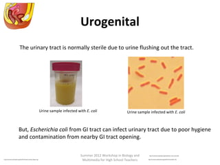Urogenital
The urinary tract is normally sterile due to urine flushing out the tract.

Urine sample infected with E. coli

Urine sample infected with E. coli

But, Escherichia coli from GI tract can infect urinary tract due to poor hygiene
and contamination from nearby GI tract opening.

http://commons.wikimedia.org/wiki/File:Female_Genital_Organs.svg

Summer 2012 Workshop in Biology and
Multimedia for High School Teachers

http://commons.wikimedia.org/wiki/File:E_choli_Gram.JPG
http://commons.wikimedia.org/wiki/File:Pyuria2011.JPG

 