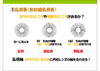 20131106 眼科諸検査入門 @眼科セミナー | PDF