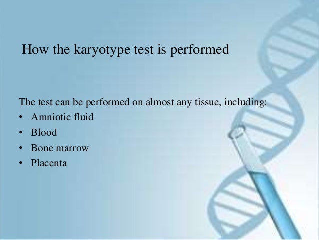 y blood test deletion karyotyping