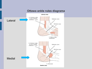 Ottawa ankle rules diagrama
Lateral
Medial
 