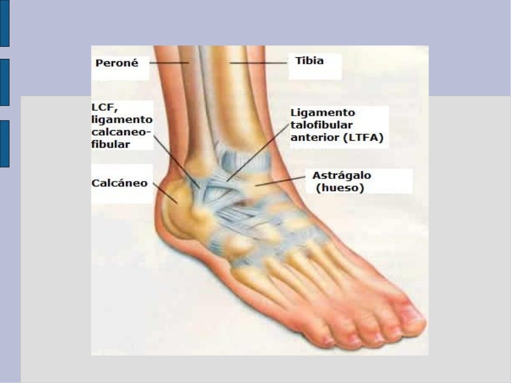 Esguince Ligamento Lateral Externo Tobillo 2013 esguinces de tobillo