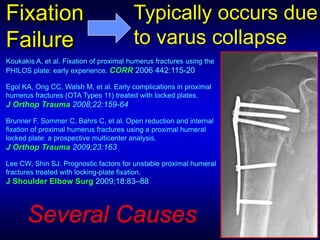 Current Concepts in Treatment of Proximal Humerus Fractures | PPTX