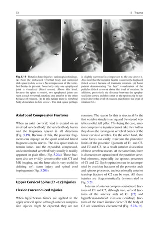 2013_Imaging_of_the_Cervical_Spine_in_Children.pdf