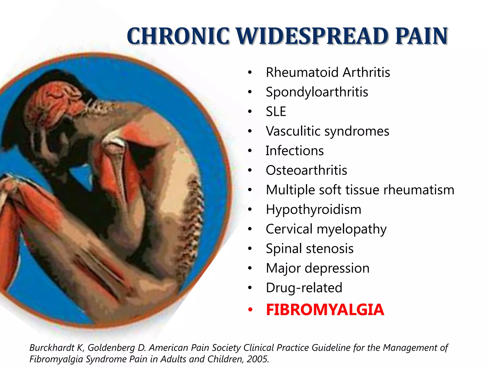 Curated visual reference: Adult Insomnia And Fibromyalgia Syndrome Reference: Updates In Fibromyalgia Diagnosis And Management
