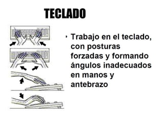 TECLADO
 