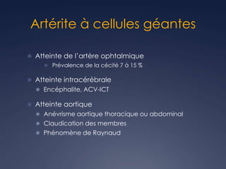 Artérite à cellules géantes
 Atteinte de l’artère ophtalmique
 Prévalence de la cécité 7 à 15 %
 Atteinte intracérébrale
 Encéphalite, ACV-ICT
 Atteinte aortique
 Anévrisme aortique thoracique ou abdominal
 Claudication des membres
 Phénomène de Raynaud
 