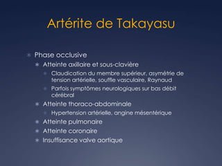 Artérite de Takayasu
 Phase occlusive
 Atteinte axillaire et sous-clavière
 Claudication du membre supérieur, asymétrie de
tension artérielle, souffle vasculaire, Raynaud
 Parfois symptômes neurologiques sur bas débit
cérébral
 Atteinte thoraco-abdominale
 Hypertension artérielle, angine mésentérique
 Atteinte pulmonaire
 Atteinte coronaire
 Insuffisance valve aortique
 