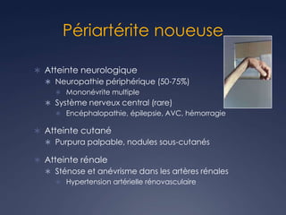 Périartérite noueuse
 Atteinte neurologique
 Neuropathie périphérique (50-75%)
 Mononévrite multiple
 Système nerveux central (rare)
 Encéphalopathie, épilepsie, AVC, hémorragie
 Atteinte cutané
 Purpura palpable, nodules sous-cutanés
 Atteinte rénale
 Sténose et anévrisme dans les artères rénales
 Hypertension artérielle rénovasculaire
 