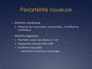 Périartérite noueuse
 Atteinte cardiaque
 Infarctus du myocarde, myocardite…insuffisance
cardiaque
 Atteinte digestive
 Première cause de décès à 1 an
 Fréquente chez les PAN-VHB
 Ischémie vasculaire
 Perforation intestinale, hémorragie
 