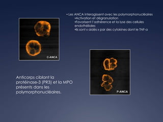 • Les ANCA interagissent avec les polymorphonucléaires
•Activation et dégranulation
•Favorisent l’adhérence et la lyse des cellules
endothéliales
•Ils sont « aidés » par des cytokines dont le TNF-α
Anticorps ciblant la
protéinase-3 (PR3) et la MPO
présents dans les
polymorphonucléaires.
 