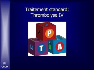 Traitement standard:
Thrombolyse IV
 
