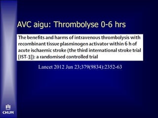 AVC aigu: Thrombolyse 0-6 hrs
Lancet 2012 Jun 23;379(9834):2352-63
 