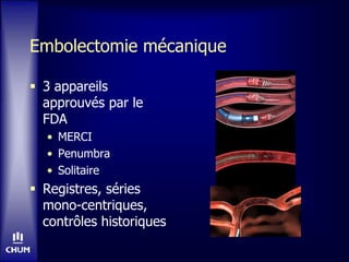 Embolectomie mécanique
 3 appareils
approuvés par le
FDA
• MERCI
• Penumbra
• Solitaire
 Registres, séries
mono-centriques,
contrôles historiques
 