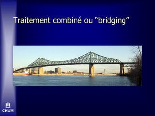 Traitement combiné ou “bridging”
 