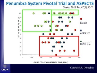 Courtesy A. Demchuk
Stroke 2011 Jan;42(1):93-7
 