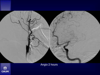 Angio 2 hours
 