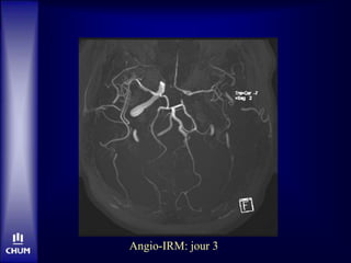Angio-IRM: jour 3
 