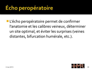  L’écho peropératoire permet de confirmer
l’anatomie et les calibres veineux, déterminer
un site optimal, et éviter les surprises (veines
distantes, bifurcation humérale, etc.).
4 mai 2013 38
 