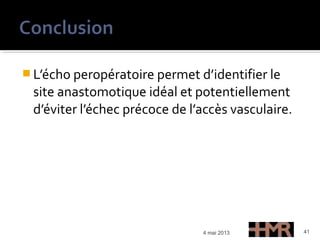  L’écho peropératoire permet d’identifier le
site anastomotique idéal et potentiellement
d’éviter l’échec précoce de l’accès vasculaire.
4 mai 2013 41
 