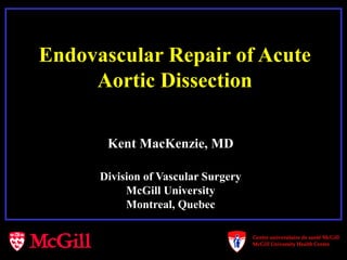 Endovascular Repair of Acute
Aortic Dissection
Kent MacKenzie, MD
Division of Vascular Surgery
McGill University
Montreal, Quebec
 