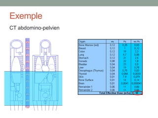 Exemple
CT abdomino-pelvien
Calcul via ImPACT, version 0.99w modifiée
 