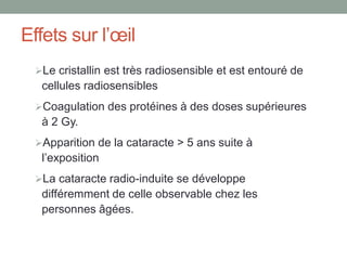 Effets sur l’œil
Le cristallin est très radiosensible et est entouré de
cellules radiosensibles
Coagulation des protéines à des doses supérieures
à 2 Gy.
Apparition de la cataracte > 5 ans suite à
l’exposition
La cataracte radio-induite se développe
différemment de celle observable chez les
personnes âgées.
 