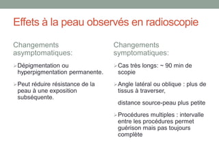 Effets à la peau observés en radioscopie
Changements
asymptomatiques:
Dépigmentation ou
hyperpigmentation permanente.
Peut réduire résistance de la
peau à une exposition
subséquente.
Changements
symptomatiques:
Cas très longs: ~ 90 min de
scopie
Angle latéral ou oblique : plus de
tissus à traverser,
distance source-peau plus petite
Procédures multiples : intervalle
entre les procédures permet
guérison mais pas toujours
complète
 