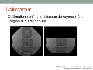 Collimation confine le faisceau de rayons x à la
région d’intérêt choisie.
Collimateur
IAEA Training Course on Radiation Protection for Doctors (non-
radiologists, non-cardiologists) using Fluoroscopy
 
