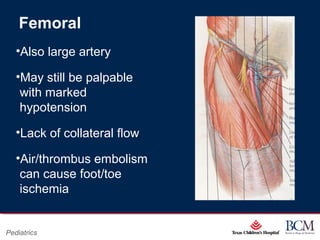 Page 10
xxx00.#####.ppt 07/16/13 02:16 AM
Pediatrics
Femoral
•Also large artery
•May still be palpable
with marked
hypotension
•Lack of collateral flow
•Air/thrombus embolism
can cause foot/toe
ischemia
 
