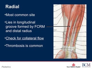Page 8
xxx00.#####.ppt 07/16/13 02:16 AM
Pediatrics
Radial
•Most common site
•Lies in longitudinal
groove formed by FCRM
and distal radius
•Check for collateral flow
•Thrombosis is common
 