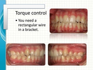 Torque control
• You need a
rectangular wire
in a bracket.
 