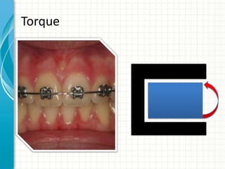 Torque
 