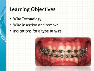 Learning Objectives
• Wire Technology
• Wire insertion and removal
• Indications for a type of wire
 