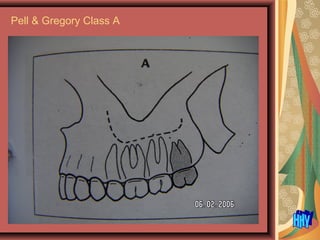 Pell & Gregory Class A
 