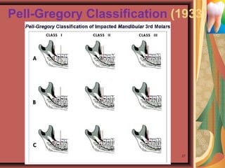 Pell-Gregory Classification (1933)
27
 