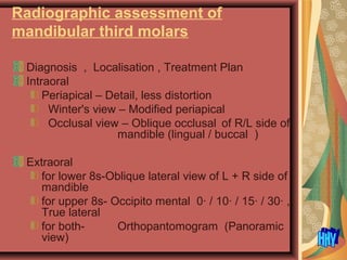Radiographic assessment of
mandibular third molars
Diagnosis , Localisation , Treatment Plan
Intraoral
Periapical – Detail, less distortion
Winter's view – Modified periapical
Occlusal view – Oblique occlusal of R/L side of
mandible (lingual / buccal )
Extraoral
for lower 8s-Oblique lateral view of L + R side of
mandible
for upper 8s- Occipito mental 0· / 10· / 15· / 30· ,
True lateral
for both- Orthopantomogram (Panoramic
view)
 