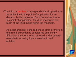 •The third or red line is a perpendicular dropped from
the white line to the point of application for an
elevator, but is measured from the amber line to
this point of application. This line measures the
depth of the third molar within the mandible.
As a general rule, if the red line is 5mm or more in
length the extraction is considered sufficiently
difficult for the tooth to be removed under general
anaesthetic or using local anaesthetic and
sedation
 