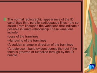 The normal radiographic appearance of the ID
canal (two thin, parallel radioopaque lines - the so-
called Tram lines)and the variations that indicate a
possible intimate relationship.These variations
include:
•Loss of the tramlines
•Narrowing of the tramlines
•A sudden change in direction of the tramlines
•A radiolucent band evident across the root if the
tooth is grooved or tunnelled through by the ID
bundle.
 