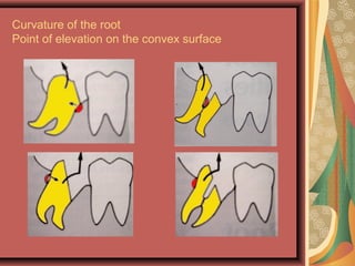 Curvature of the root
Point of elevation on the convex surface
 
